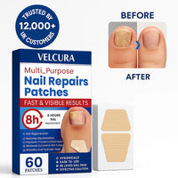 Velcura™ – Fungal Nail Renewal Patches My Store