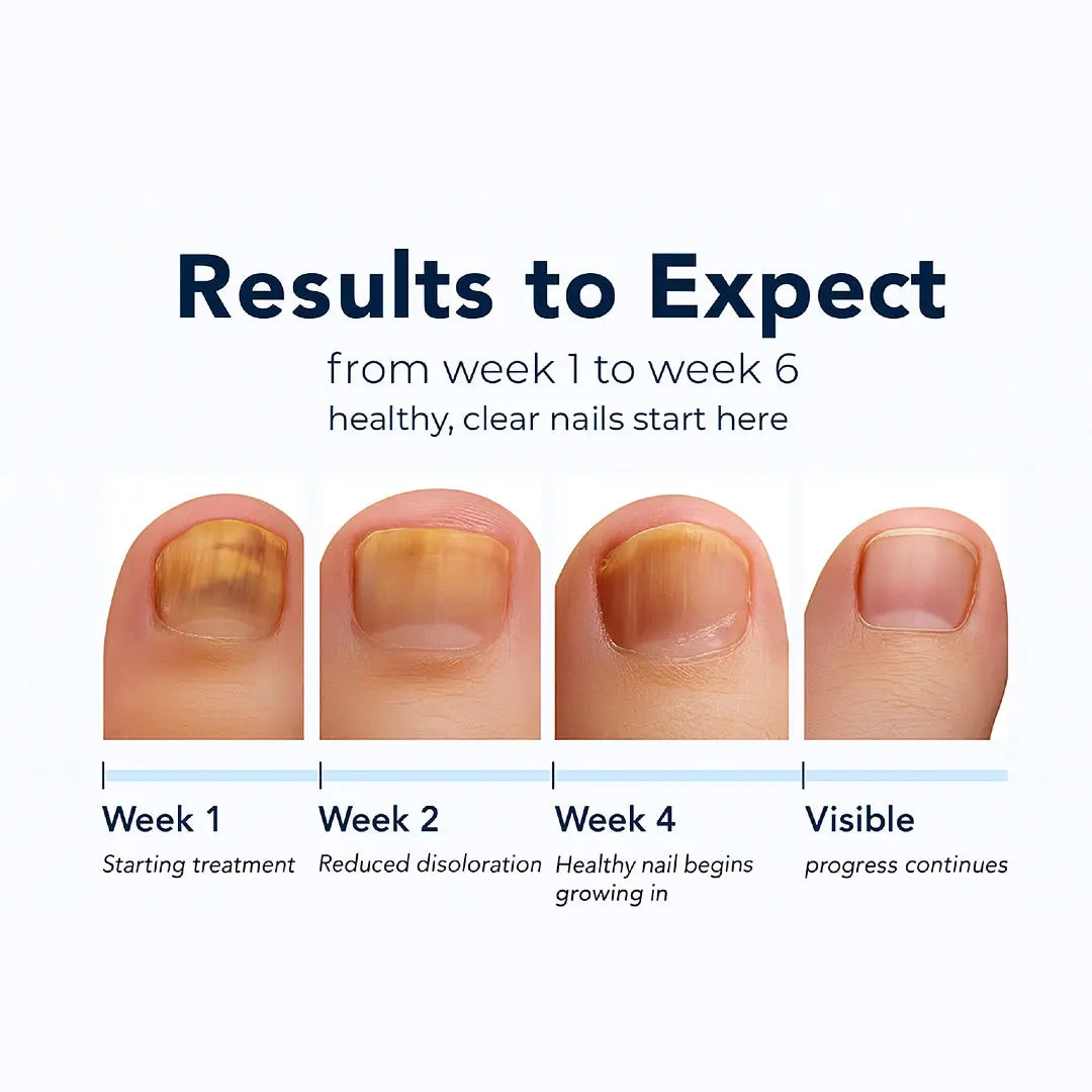 Velcura™ – Fungal Nail Renewal Patches My Store
