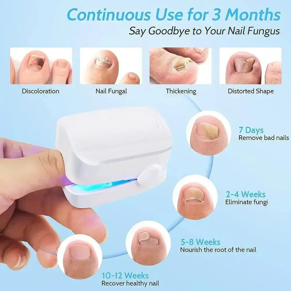 Anti-Fungus LED Device Velcura
